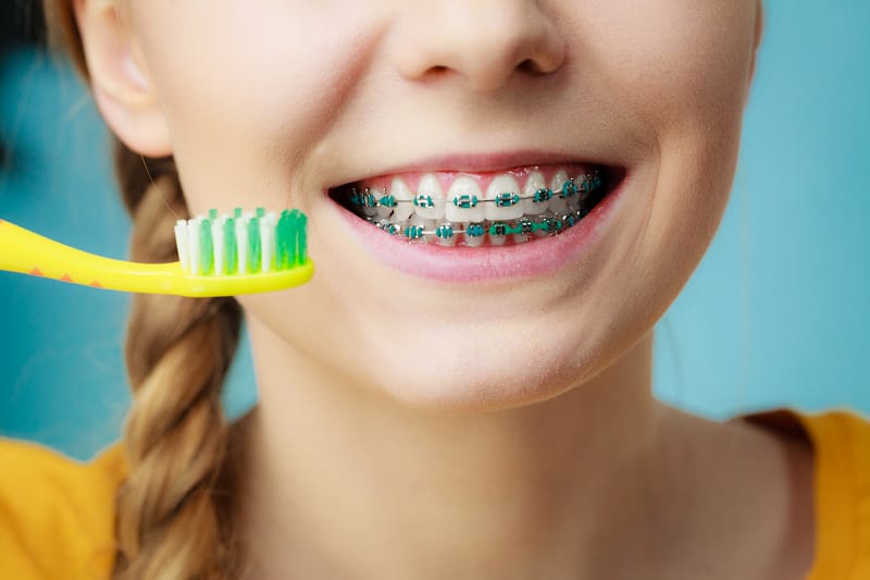 7 Tips to Prepare Your Child for Braces 1 braces
