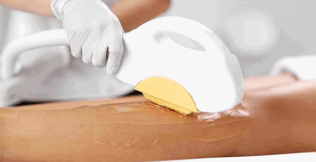 HOW DO IPL AND LASER HAIR REMOVAL ACTUALLY WORK? 1 LASER HAIR REMOVAL