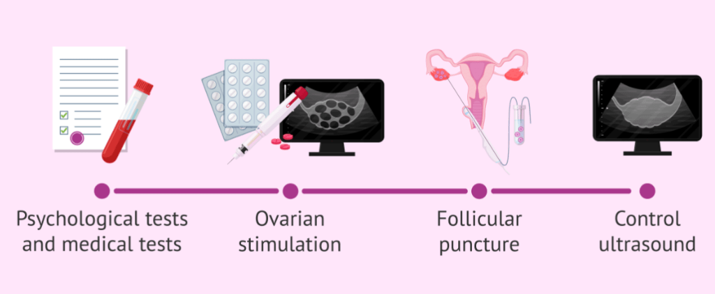 egg donation process