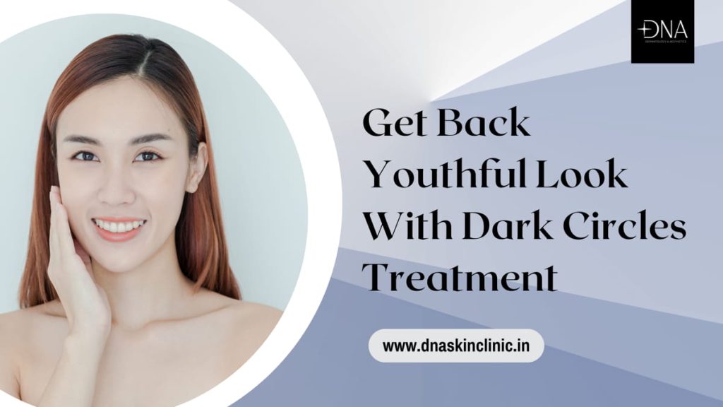 Get Back Youthful Look With Dark Circles Treatment 1 dark circles treatment