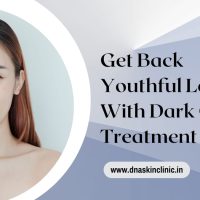 dark circles treatment